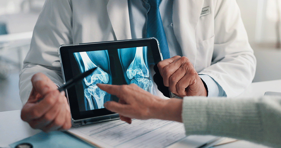 Doctor reviewing a knee X‑ray on a tablet during an assessment of arthritis in the knee joint.