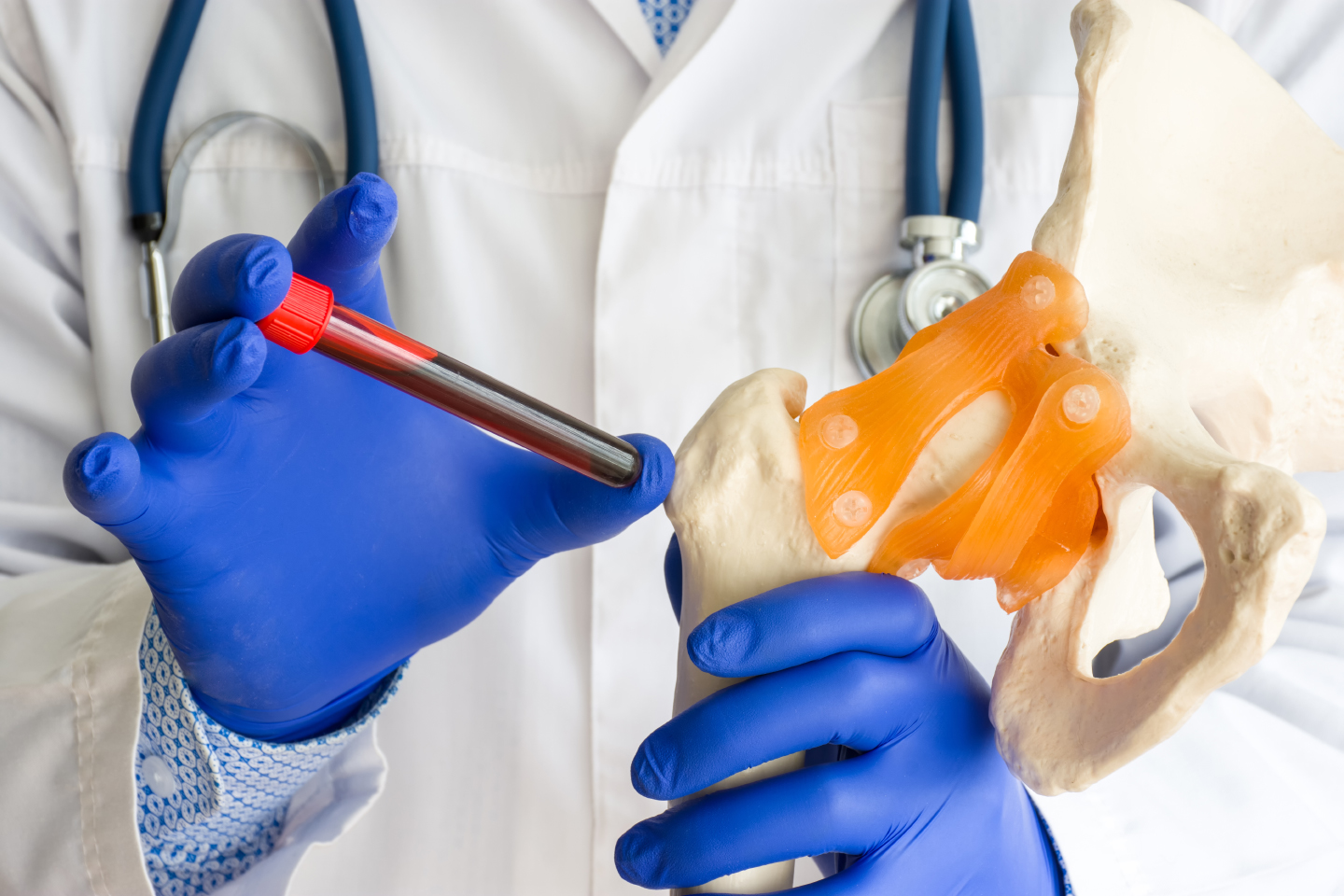 Doctor holding up blood test for rheumatism treatment