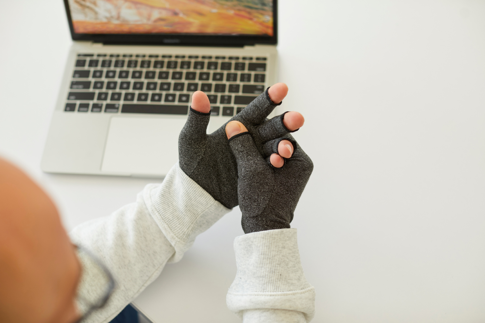 Patient wearing compression gloves for psoriatic arthritis hand pain
