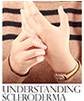 Understanding Scleroderma April 2013