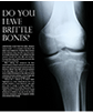 Do You Have Brittle Bones July 2012